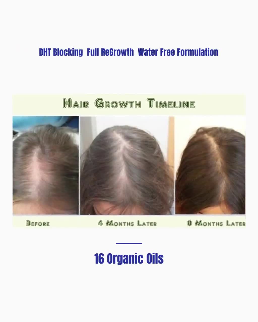 Best & Fastest Hair Loss Re-growth Shampoo and Conditioner - Etsy